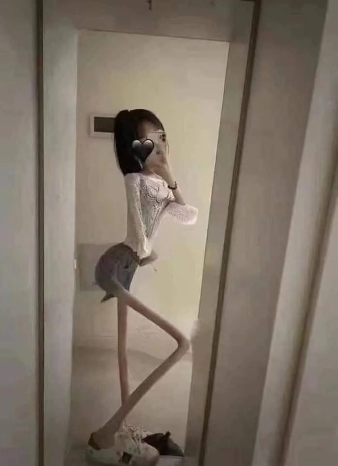 너무 말라서 고민이에요