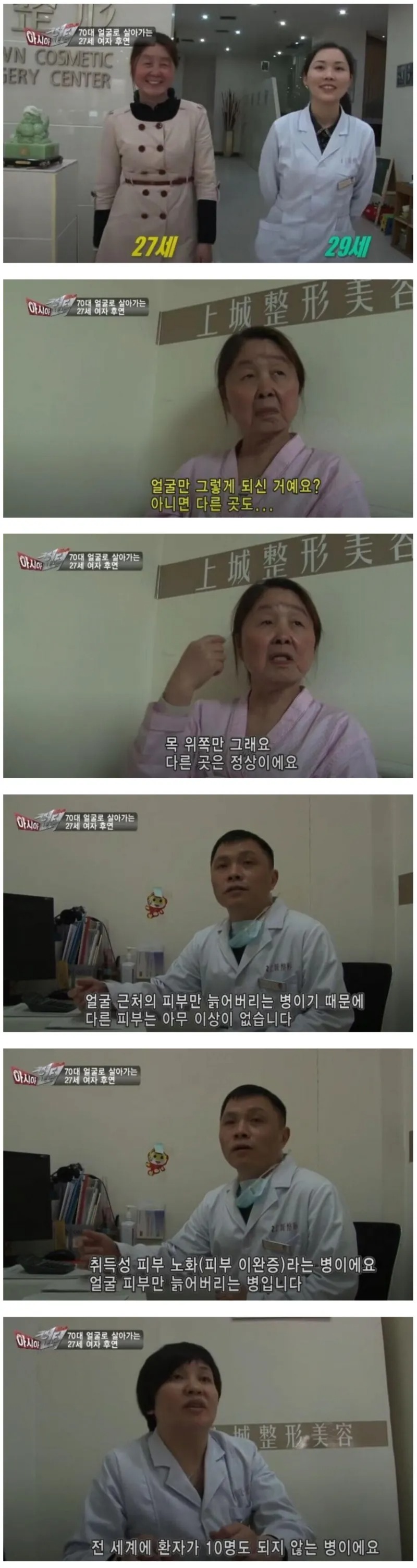 목 위만 70대로 살아가는 여성