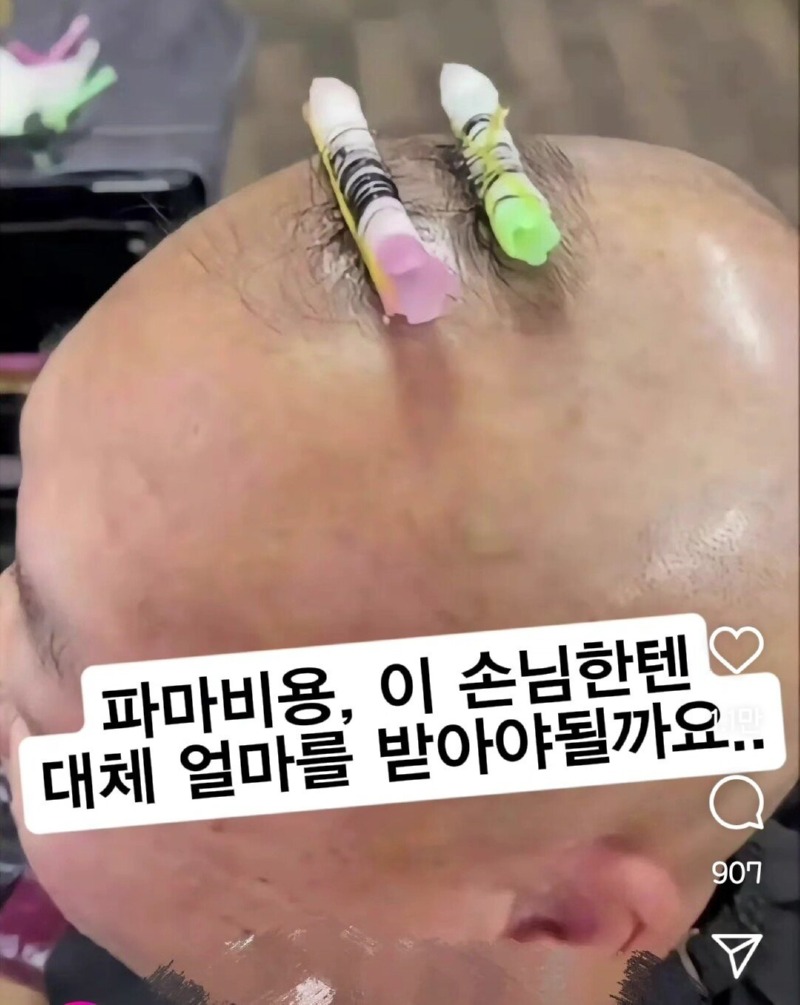 파마 비용 논쟁, 얼마를 받아야 할까 
