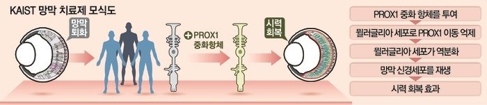 떨어진 시력도 회복 가능...세계최초로 망막 재생 성공