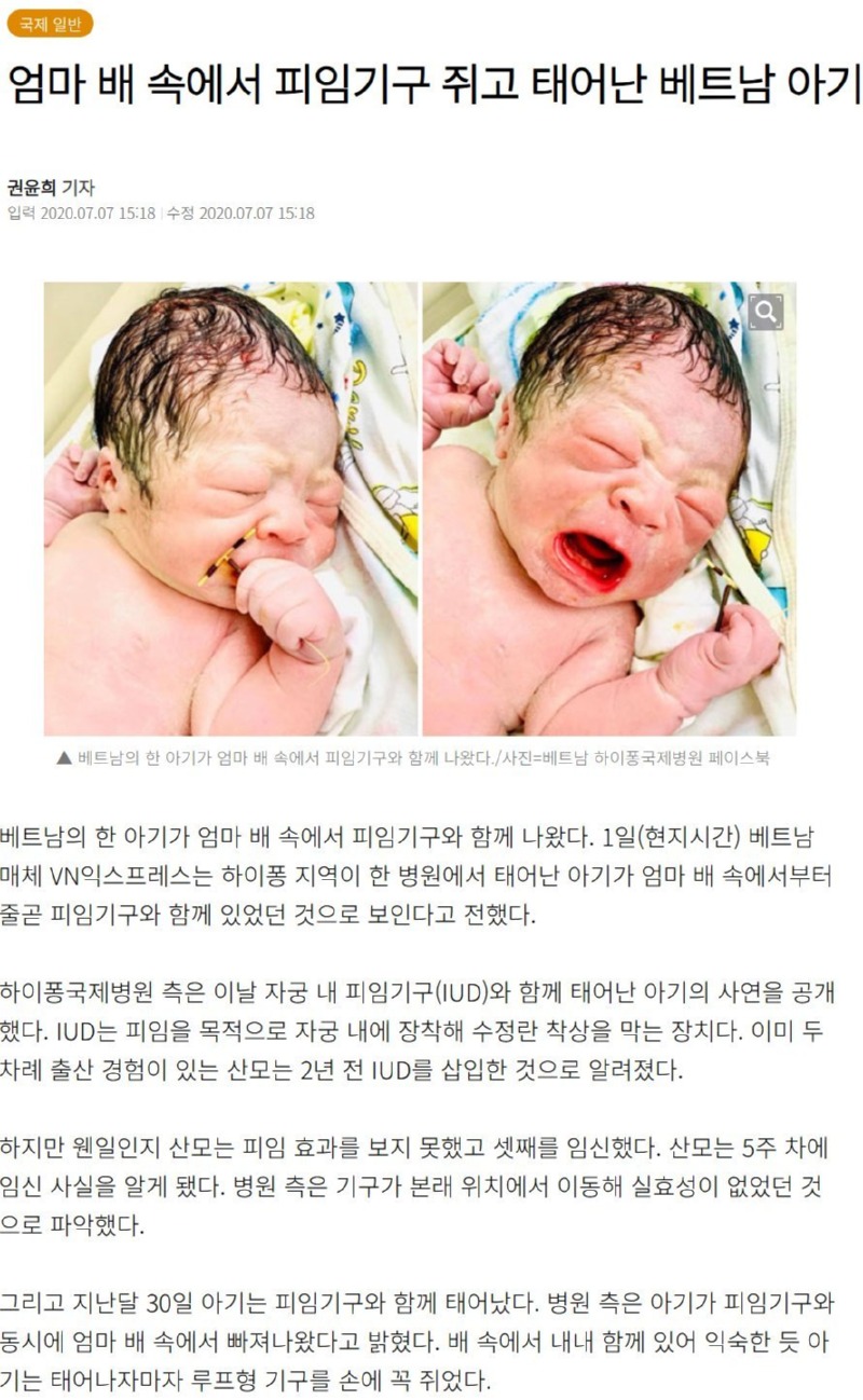 무려 2% 의 확률로 태어난 아기